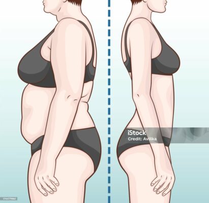 Illustration: Körperveränderung durch Abnehmen mit Mounjaro